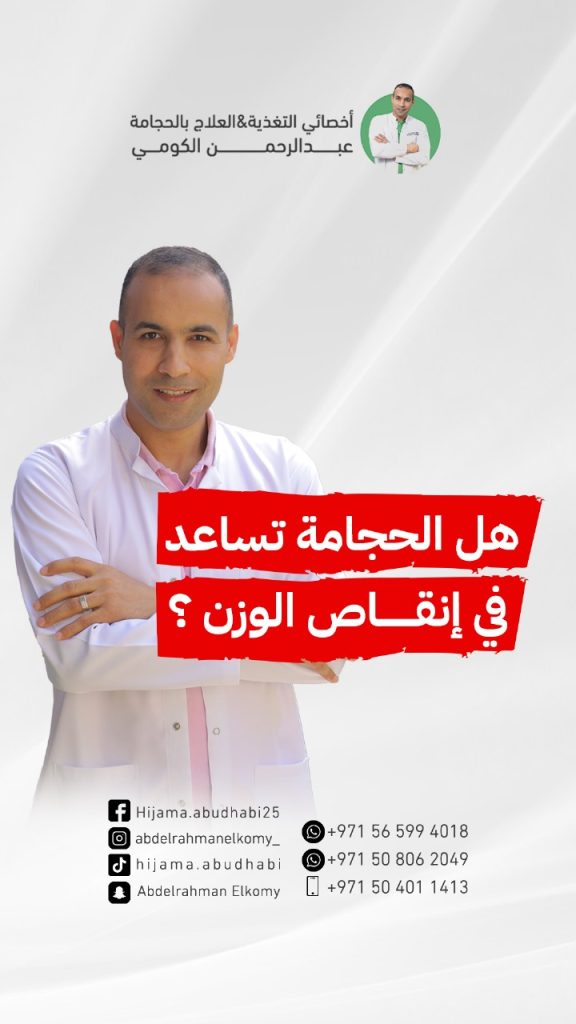 فوائد الحجامة في انقاص الوزن فوائد الحجامة في تفتيت الدهون وانقاص الوزن تجربتي مع الحجامة للتنحيف
