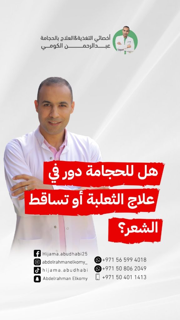 هل تفيد الحجامة في علاج الثعلبة؟ هل الحجامة مفيدة للصلع الوراثي؟