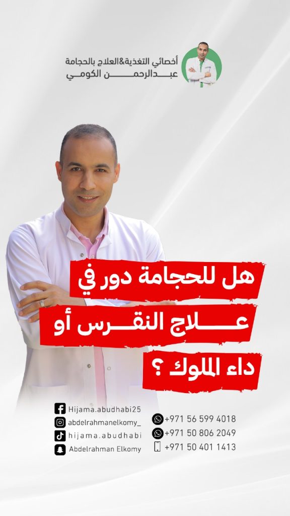 هل الحجامة تعالج حمض اليوريك؟