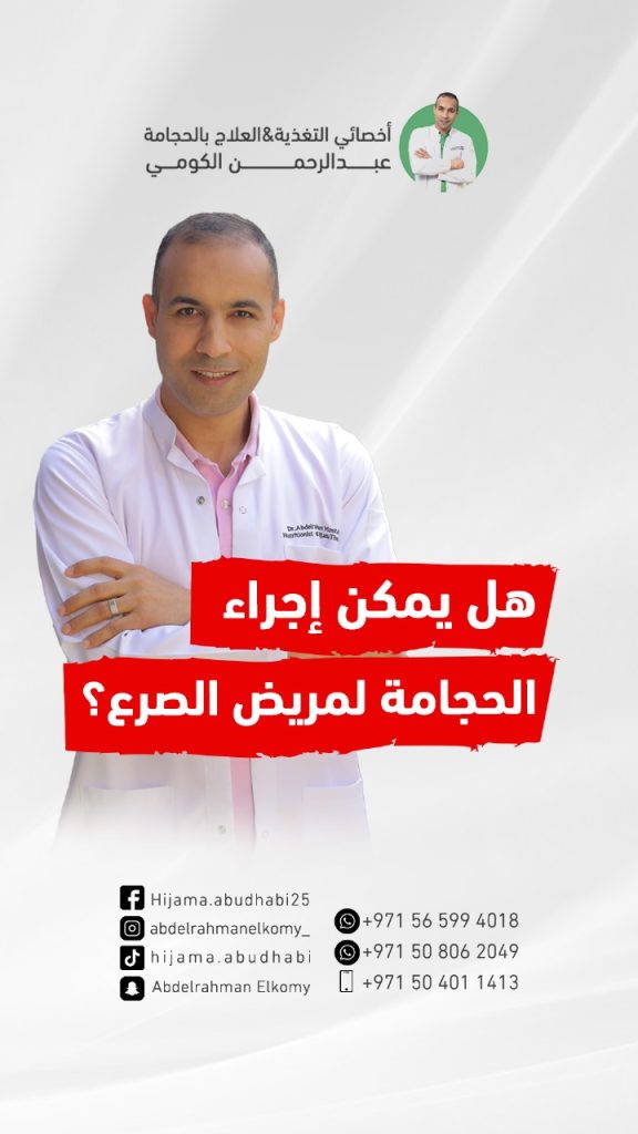 هل فعلا الحجامة تعالج الصرع؟